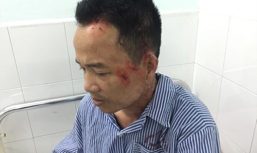 Anh Nguyễn Thành Long với các vết thương và 22 mũi khâu hiện đang điều trị tại Bệnh viện Việt Tiệp. Ảnh: HH