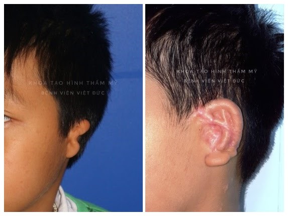 Hình ảnh trước và sau phẫu thuật. Ảnh: BSCC