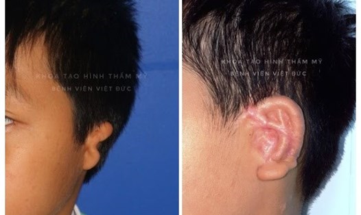 Hình ảnh trước và sau phẫu thuật. Ảnh: BSCC