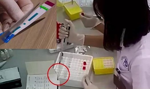 Nhân viên y tế Bệnh viện Đa khoa Xanh Pôn (Hà Nội) cắt đôi que xét nghiệm HIV, viêm gan B.
