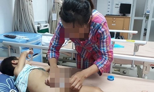 Hiện nay đã có trên 100 trẻ mắc bệnh sùi mào gà sau khi thực hiện các thủ thuật nong tách bao quy đầu ở phòng khám của bà Hoàng Thị Hiền.