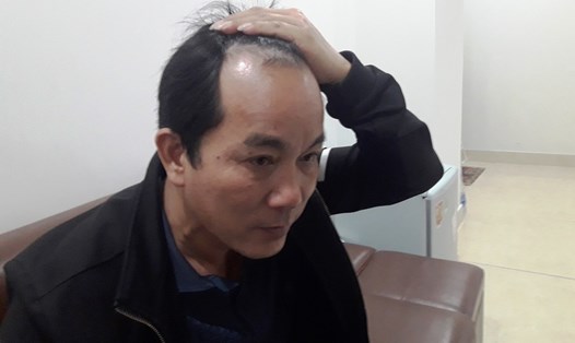 Anh Hải kể lại việc mình bị tài xế Phan Văn Lĩnh dùng tuýp sắt đánh vào đầu hôm 9.2. Ảnh: Trần Tuấn