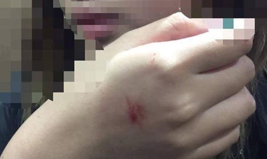 Mức xử phạt vụ sàm sỡ trong thang máy được báo chí nước ngoài gọi là "Tấn công tình dục" chỉ tương đương 8,41 USD, hay 10.000 won.