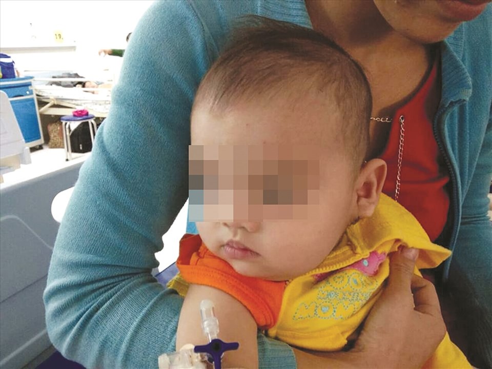 Điều trị u bướu làm biến dạng mặt trẻ nhỏ. Điều trị u bướu làm biến dạng mặt trẻ nhỏ.