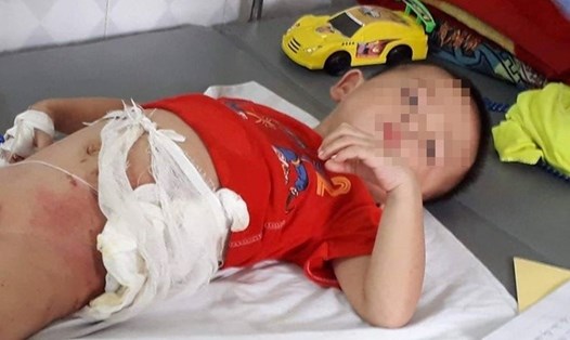 Cháu Bùi Nguyễn Thanh Lâm đang điều trị tại bệnh viện. 