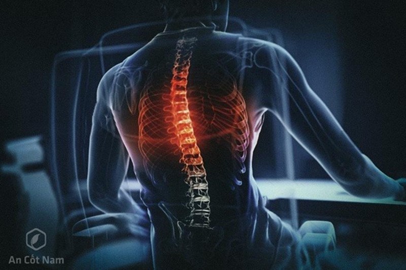 Đau đau lưng bên trái ở giữa Nguyên nhân và cách điều trị