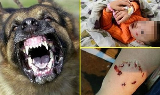 Nhiều trường hợp bị chó dại cắn dẫn đến tử vong.