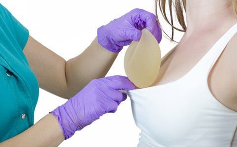 Các triệu chứng sau khi nâng ngực và hướng dẫn chăm sóc Thực hư việc nổ túi ngực khi đi máy bay, bác sĩ lý giải bất ngờ