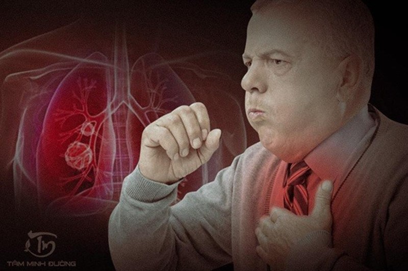 Ho đau ngực giữa có thể là triệu chứng của bệnh tim mạch?
