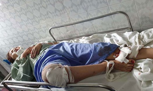 Em Lường Thị Thu đang điều trị tại khoa Cấp cứu, Bệnh viện Việt Đức (Hà Nội). Ảnh: HẠNH LƯƠNG
