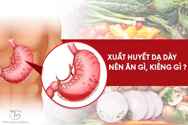 Các Nguyên Tắc Ăn Uống Hỗ Trợ Phục Hồi Xuất Huyết Dạ Dày