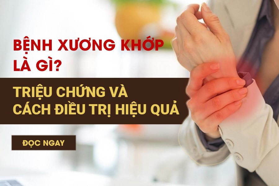 Bệnh xương khớp là gì? Triệu chứng và cách điều trị hiệu quả