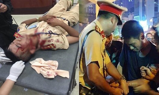 Bị dừng xe do vi phạm luật giao thông, Nguyễn Quang Hùng dùng đá tấn công đại úy cảnh sát phải nhập viện. Ảnh: FB