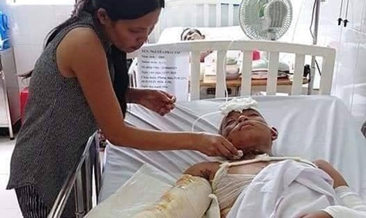 Em Tài hiện đang điều trị tại Bệnh viện Nhi đồng 1, TPHCM trong khi gia đình khánh kiệt. Ảnh: CTV