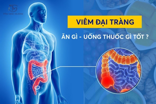 Đau Đại Tràng Uống Gì? Giải Pháp Từ Thiên Nhiên Đến Y Học Hiện Đại