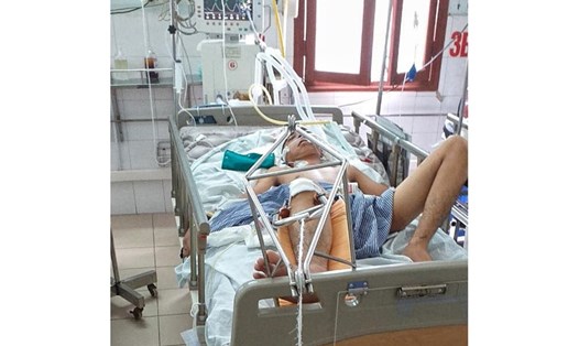 Em Nguyễn Đăng Chung nằm bất tỉnh, đang được điều trị tại Bệnh viện Hải Phòng. Ảnh: YẾN VŨ