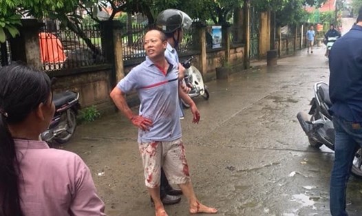 Nguyễn Văn Đông bị bắt giữ ngay tại hiện trường vụ án mạng. Ảnh CTV