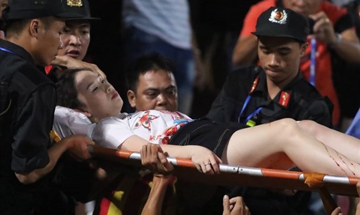 Nữ cổ động viên vô tội trong trận đấu Hà Nội FC và Nam Định FC bị thương nặng ở chân đến nỗi phải nhập viện tối 11.9. Ảnh: Trần Tiến
