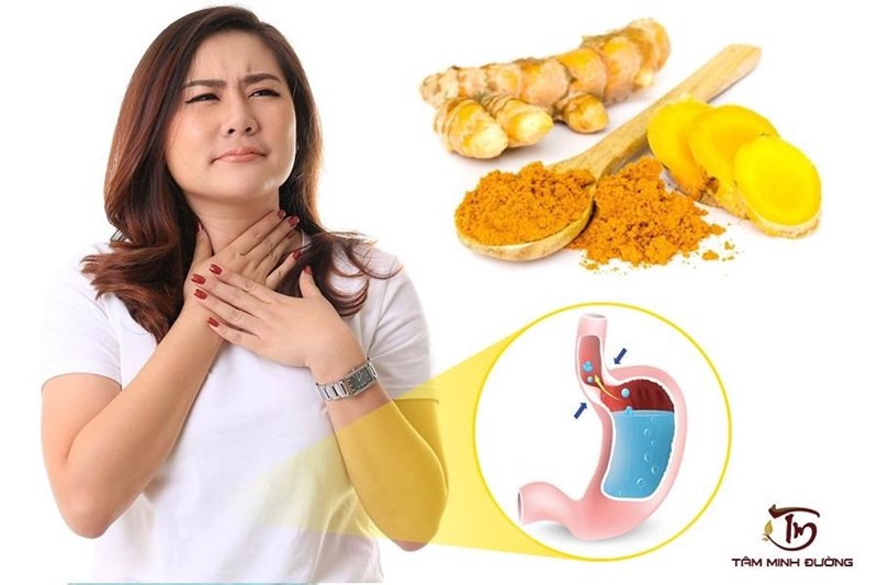 Nghệ và mật ong có tác dụng kháng vi khuẩn và chống viêm có liên quan đến trị trào ngược dạ dày không?
