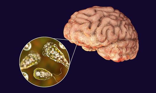 Ký sinh trùng ăn não người xâm nhập vào cơ thể qua đường mũi, lên não và phá hủy mô não. Ảnh: Genesis