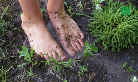 Hạn chế tiếp xúc với đất hoặc nước bùn, đặc biệt là những nơi bị ô nhiễm nặng để tránh mắc bệnh Whitmore.
