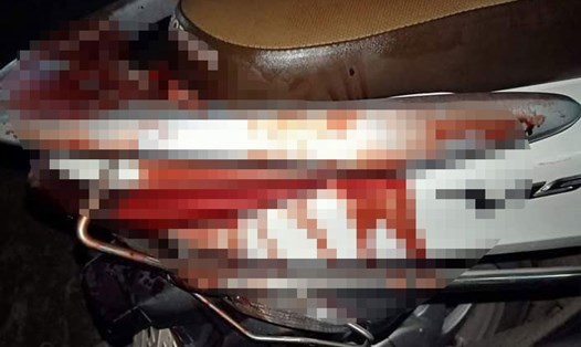 Vết máu bắn lên chiếc xe máy của gia đình nạn nhân. Ảnh: D.H.