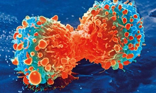 Liệu pháp tế bào CAR-T được xem là bước đột phá trong điều tri miễn dịch ung thư. Ảnh: NIH