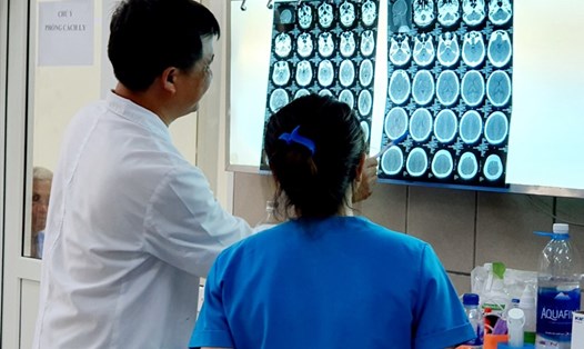 Hình ảnh phim chụp não bệnh nhân bị xuất huyết do ngộ độc ma túy đá. Ảnh: MT