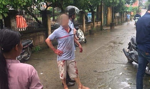 Đối tượng Nguyễn Văn Đông bình thản sau khi truy sát cả gia đình em trai. Ảnh: FB.
