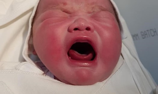 Bé sơ sinh nặng 5,1kg sinh tại Bệnh viện Đa khoa tỉnh Phú Thọ.