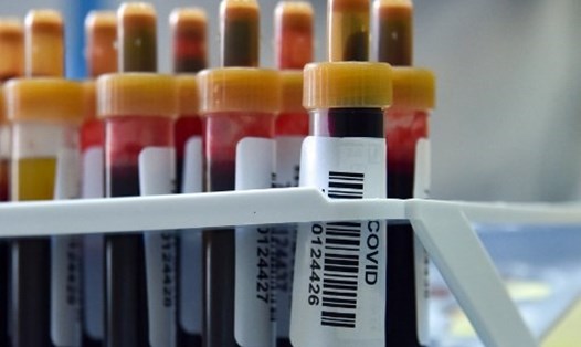 Những người nhóm máu O hoặc B ít có nguy cơ mắc COVID-19 hơn nhóm A hoặc AB. Ảnh: AFP