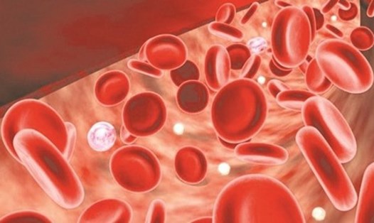 Thiếu máu là tình trạng cơ thể không có đủ tế bào hồng cầu khỏe mạnh để vận chuyển đầy đủ oxy đến các cơ quan. Ảnh minh họa.