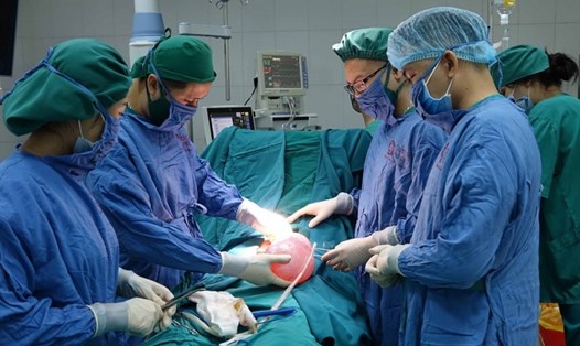 Các bác sĩ lấy khối u buồng trứng khổng lồ cho bệnh nhân. Ảnh do bác sĩ cung cấp.