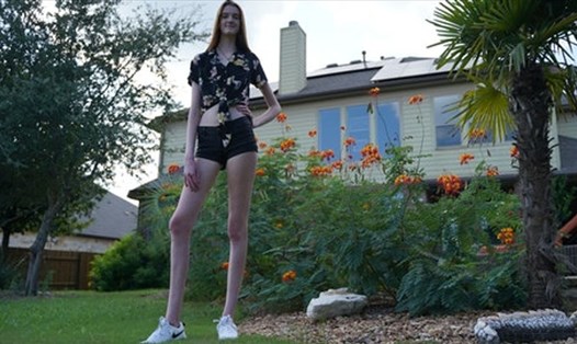 Thiếu nữ 17 tuổi đến từ Texas, Mỹ đã giành được kỉ lục người phụ nữ có đôi chân dài nhất thế giới. Ảnh: News Sky