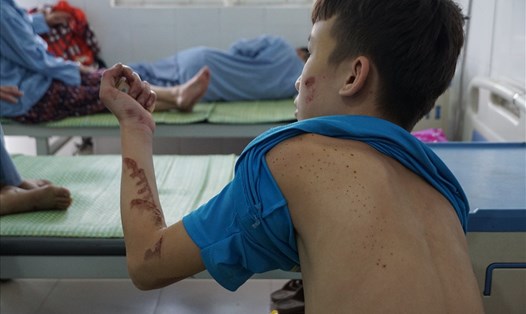 Hình ảnh vết thương trên cơ thể của Trương Quang D. Ảnh: Tùng Giang