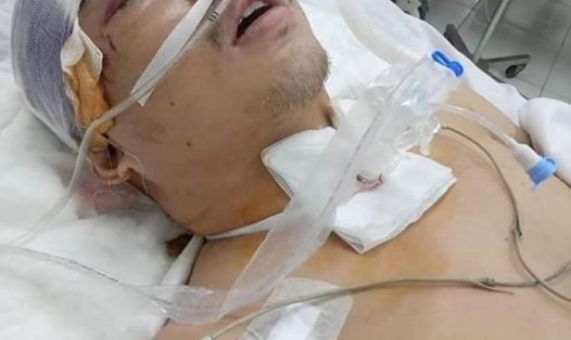 Anh Trần Đình Quang hiện vẫn bất tỉnh, nằm điều trị tại Bệnh viện Quân Y 103 (Hà Đông, Hà Nội). Ảnh: L.H