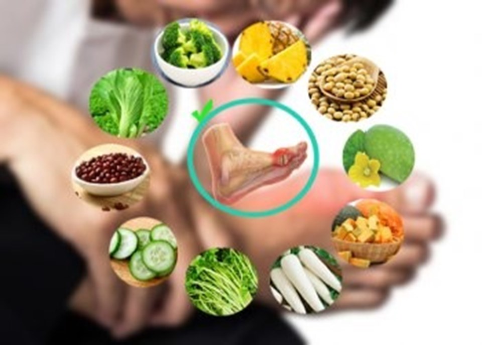 Dinh dưỡng hợp lý cho người bệnh gút. Ảnh do bệnh viện cung cấp. Dinh dưỡng hợp lý cho người bệnh gút. Ảnh do bệnh viện cung cấp.