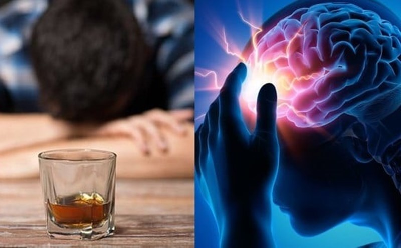 Viêm gan ứ mật cấp nghi do rượu thuốc