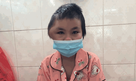 Bé H Sine Bkrông (11 tuổi, buôn KomLeo, xã Hoà Thắng, TP.Buôn Ma Thuột, tỉnh Đắk Lắk) mang trên mặt khối u ác tính. Ảnh: GĐCC