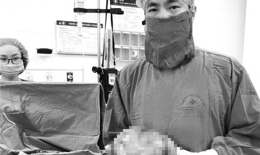 Bác sĩ Nguyễn Xuân Hải phẫu thuật thành công lấy khối u gần 4kg cho người bệnh. Ảnh: BVCC