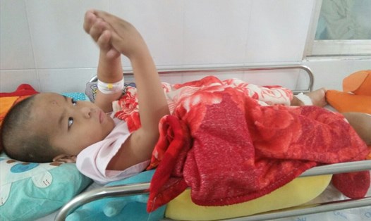 Bé Nguyễn Văn Việt Nam (5 tuổi) không may mắc bệnh ung thư máu đã 2 năm nay. Ảnh: GĐCC