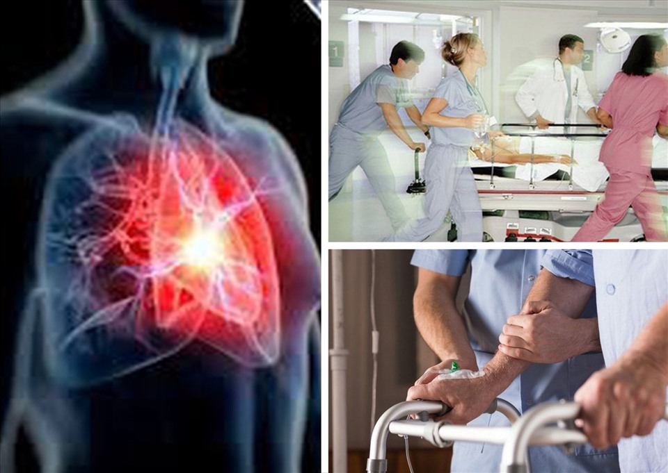 Trời lạnh giá là một trong những nguyên nhân khiến bệnh nhân đột quỵ gia tăng. Ảnh đồ họa: Phạm Công
