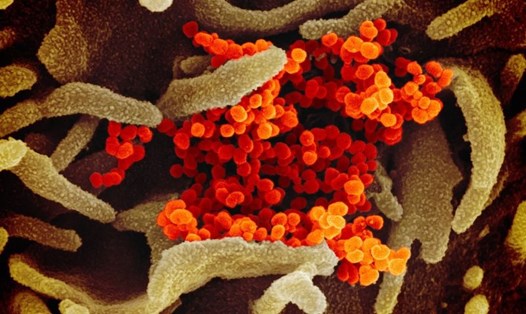 Bức ảnh này cho thấy một mẫu virus (màu cam) đang được phân tách từ một bệnh nhân ở Mỹ và được nuôi cấy trong phòng thí nghiệm. Nguồn: NIAID-MRL.