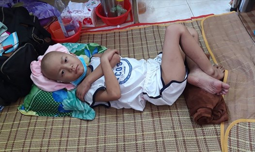 Bé Lương Gia Kiệt (sinh năm 2013) đang từng ngày đấu tranh với căn bệnh ung thư máu tại Bệnh viện Ung Bướu TP.Hồ Chí Minh. Ảnh: TK