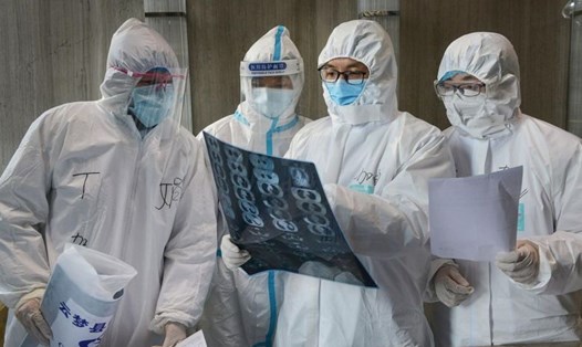 Các bác sĩ một bệnh viện ở Hồ Bắc hội ý phim chụp phổi của bệnh nhân COVID-19. Ảnh: AFP