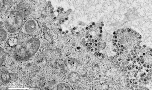 Hình ảnh virus Corona được các nhà khoa học chụp lại qua kính hiển vi. Ảnh: Đại học Hongkong- Trung Quốc.
