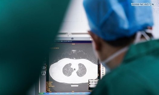 Một bác sĩ kiểm tra hình ảnh CT phổi của bệnh nhân tại Bệnh viện thành phố Chương Châu, phía đông nam tỉnh Phúc Kiến, Trung Quốc ngày 2.2. Ảnh: Xinhua