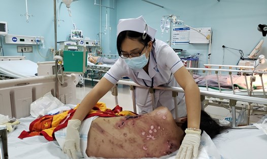 Nạn nhân bị đánh bầm dập, đang được điều trị tại bệnh viện đa khoa Đồng Nai_Ảnh: HAC