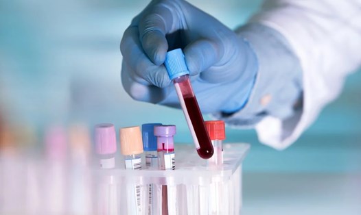 Nghiên cứu của Trung Quốc cho thấy những người nhóm máu A dễ bị mắc COVID-19 hơn. Ảnh: Shutterstock