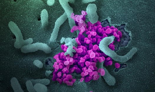 Hình ảnh virus SARS-CoV-2. Ảnh: AFP.